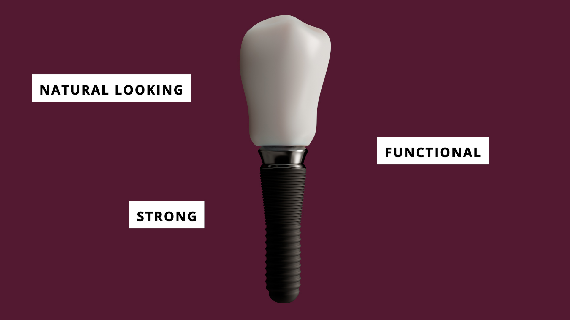 THE EVOLUTION OF DENTAL IMPLANTS